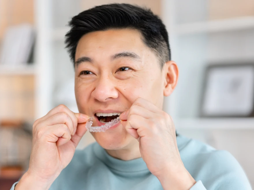 A man fitting a clear aligner
