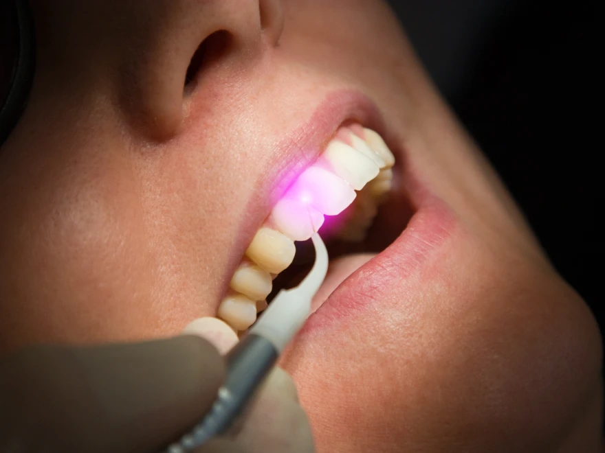 A close-up of a dental instrument with a pink light at a patient's mouth